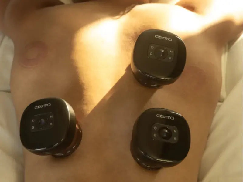 Cupping for liver detox shown with three smart cupping devices placed on the torso.