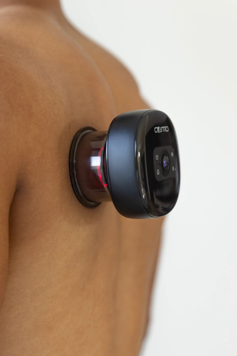 Electric cupping device attached to a person's back with visible red light therapy during a massage session.