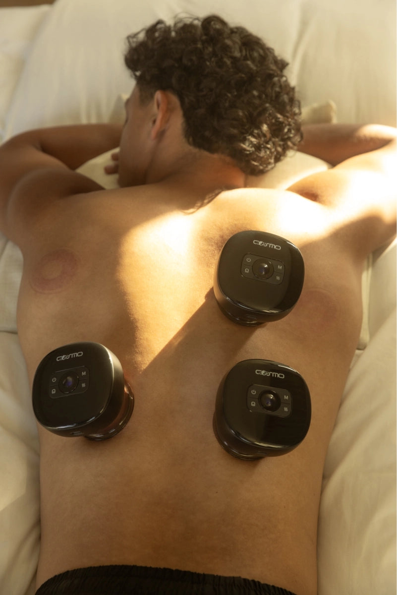 Smart cupping device applied in multiple spots on man's back as he lies on a bed during therapy session.